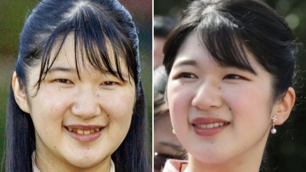 愛子さまの歯並びの比較画像