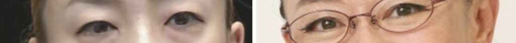 瑶子さまと柴田理恵の目の比較画像